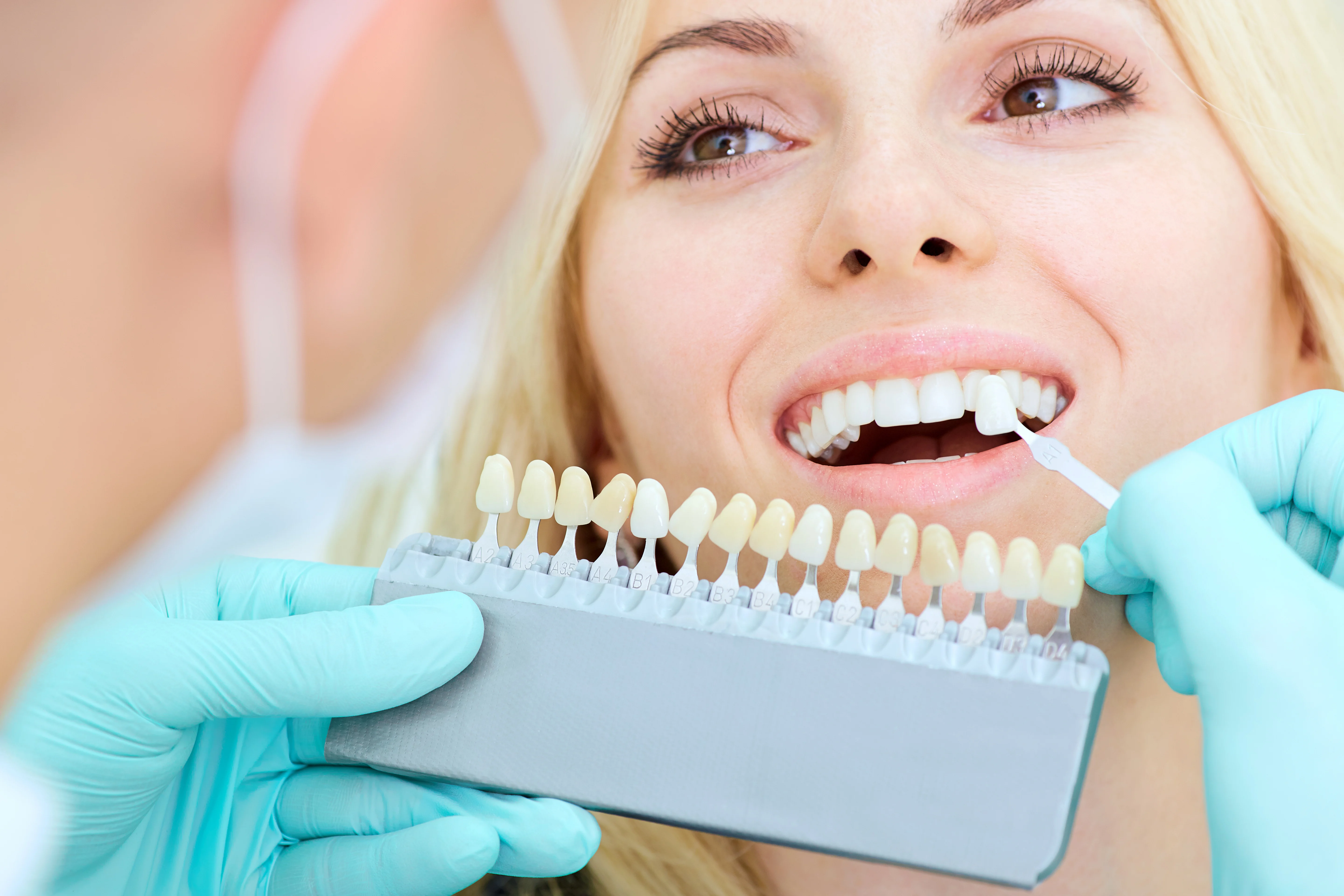 Teeth Whitening Cosmocare